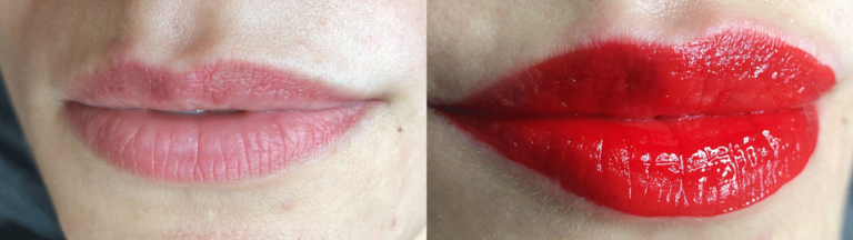 Antes-e-depois-1