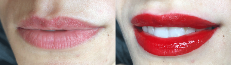 Antes-e-depois-2