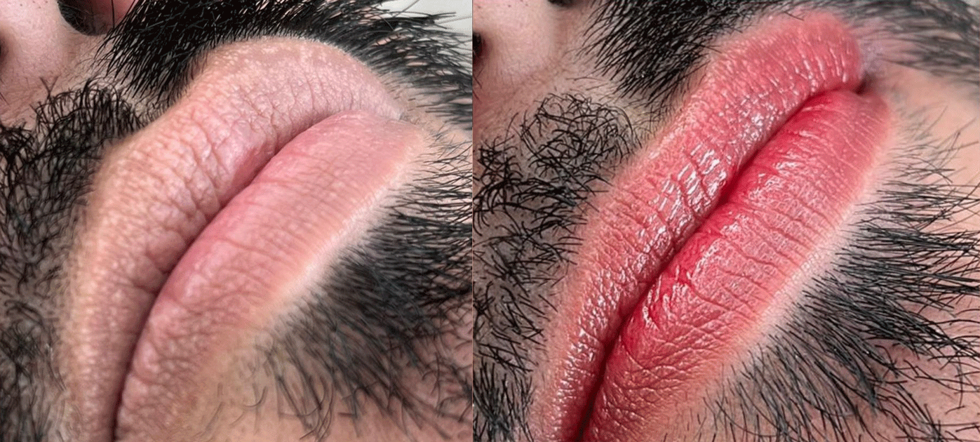 Antes-e-depois-3